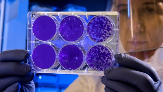 Climate Change and Infectious Disease